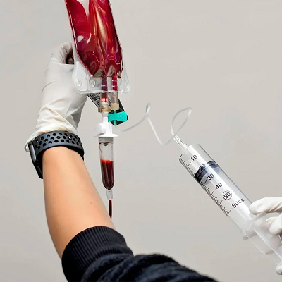 Can Ozone Therapy Help Improve Blood Circulation