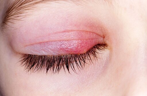 Eyelid Care Guide